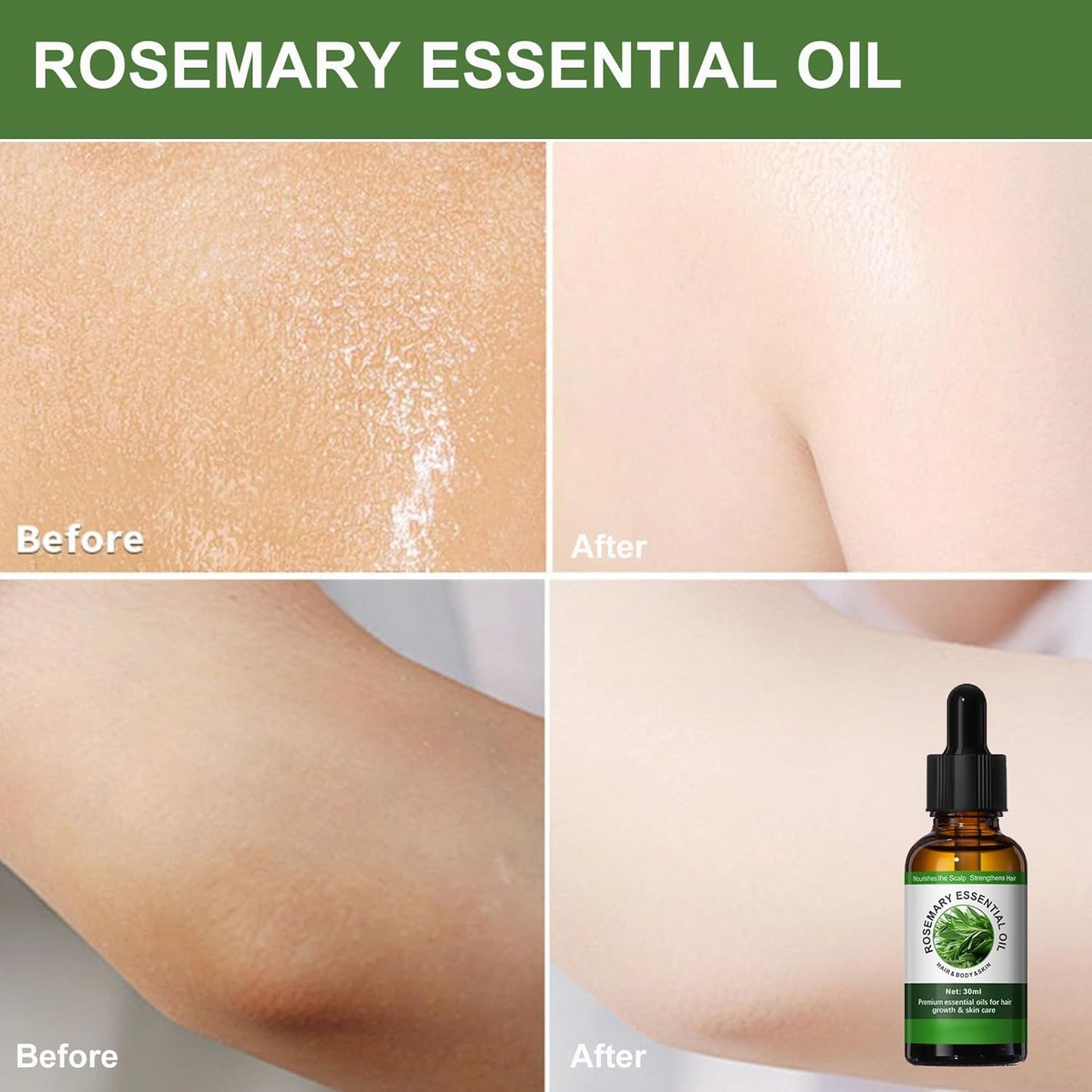 Rosemary Essential Oil - Massage Oil - Body Oil for Skincare, Massage, Bathing - Nourishes Skin and Repairs Split Ends Hair - Non-Sticky,Fast-Absorbing